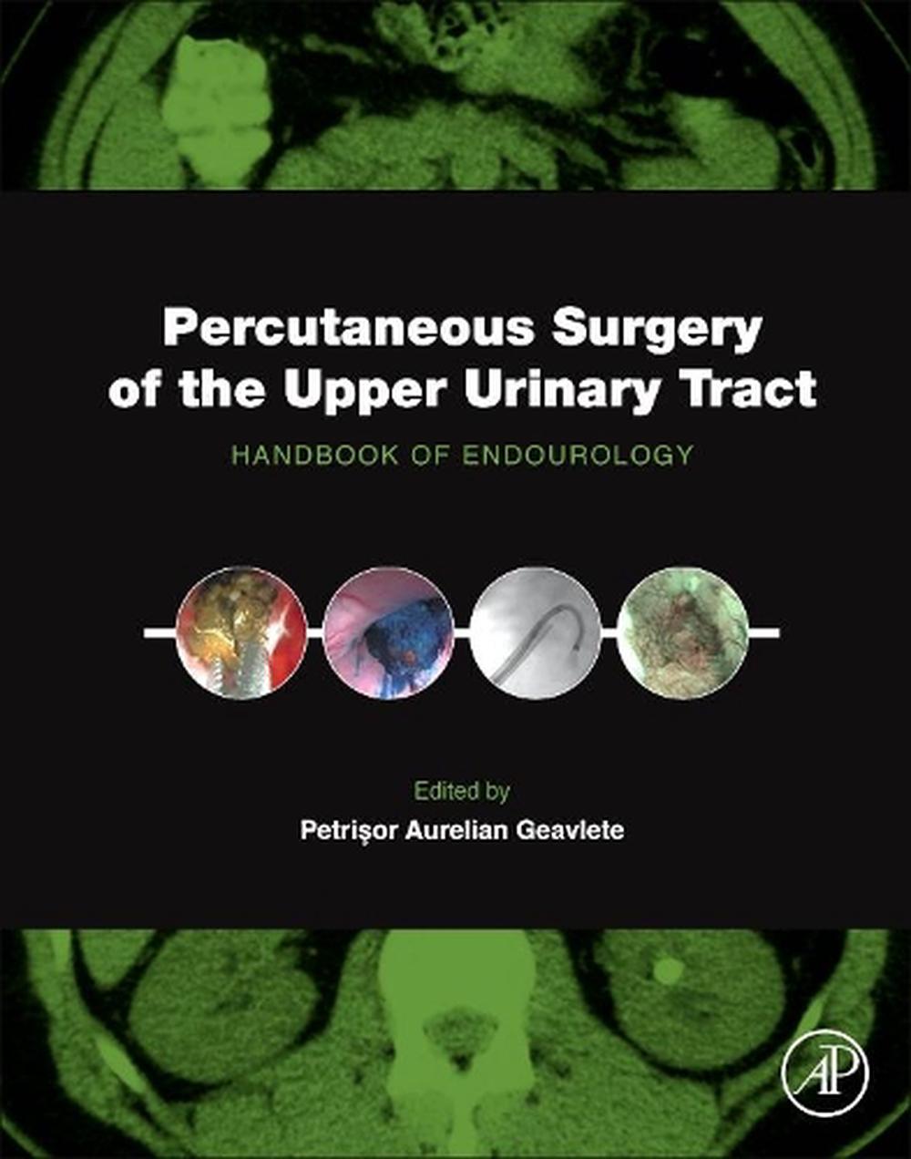 Percutaneous Surgery Of The Upper Urinary Tract Handbook Of 5584