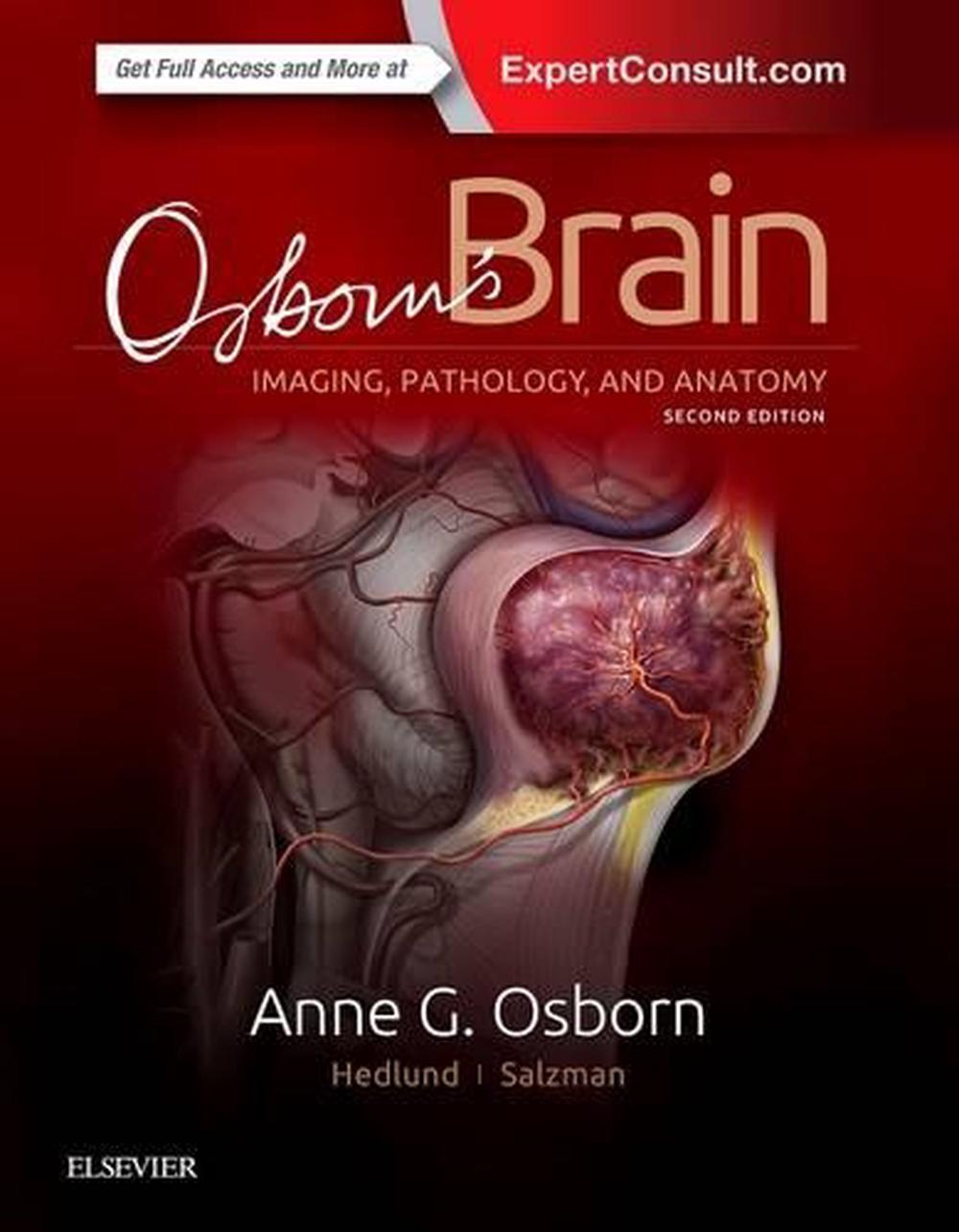 Osborn's Brain by Anne G. Osborn (English) Hardcover Book Free Shipping ...