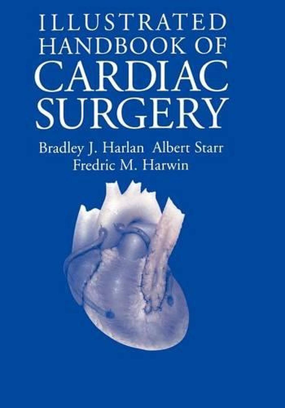 literature review on cardiac surgery