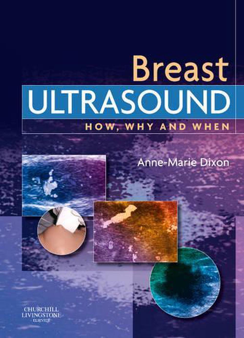 Breast Ultrasound How Why And When By Anne Marie Dixon English