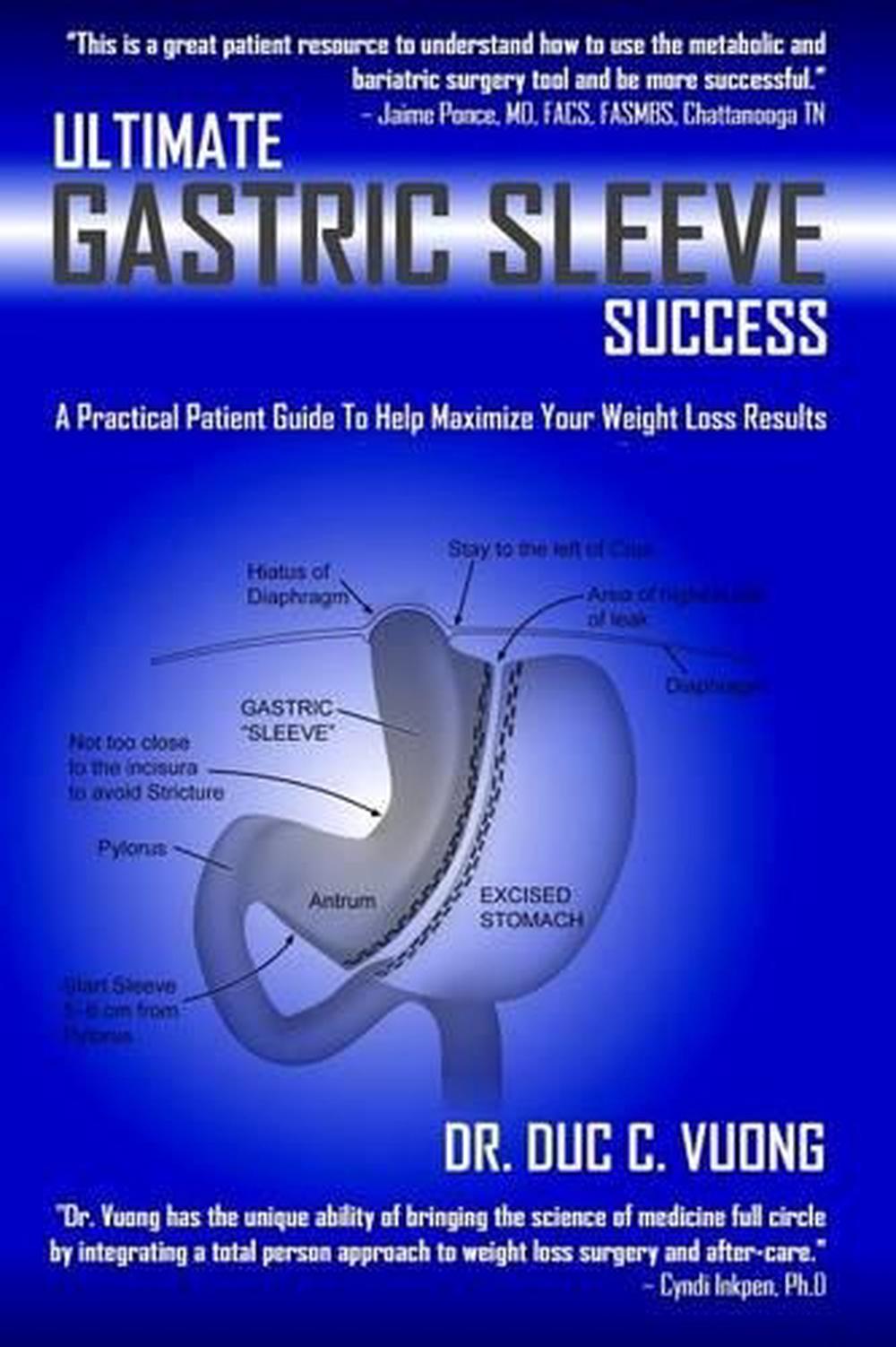 gastric sleeve 10 years later