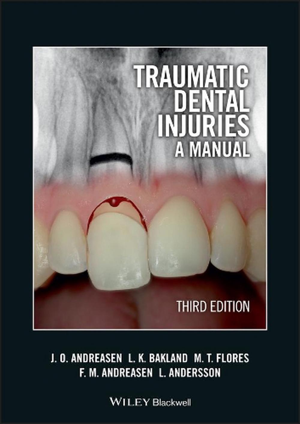 Traumatic Dental Injuries: A Manual by Jens O. Andreasen (English ...