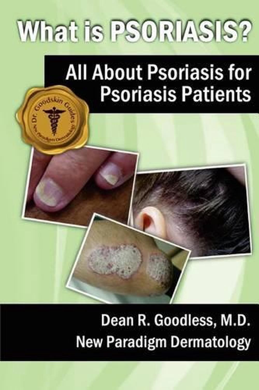 What Is Psoriasis?: All about Psoriasis for Psoriasis Patients by Dean ...