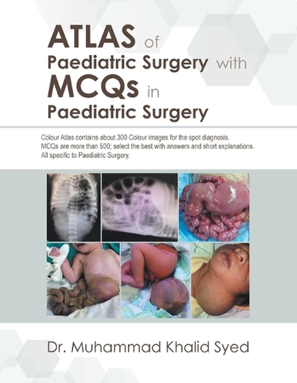 Atlas Of Paediatric Surgery With Mcqs In Paediatric Surgery By Dr