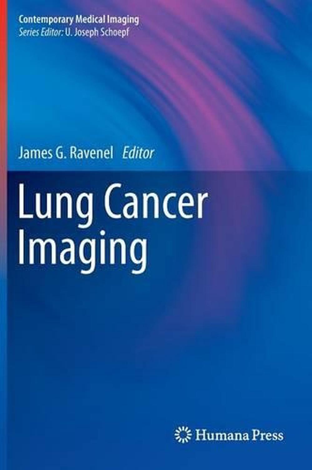 Lung Cancer Imaging (English) Hardcover Book Free Shipping