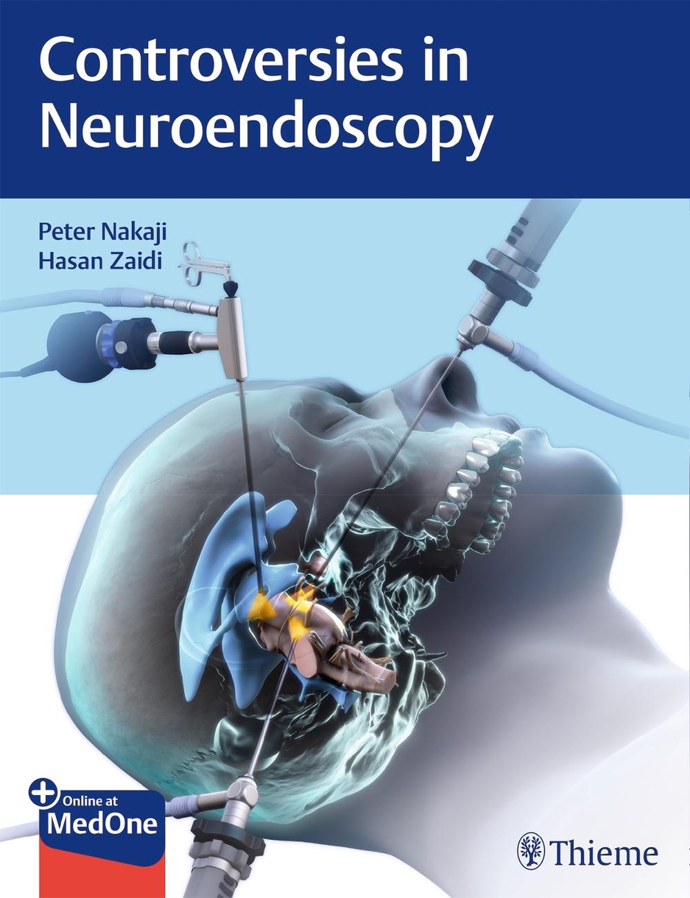 Controversies in Neuroendoscopy by Peter Nakaji Hardcover Book Free