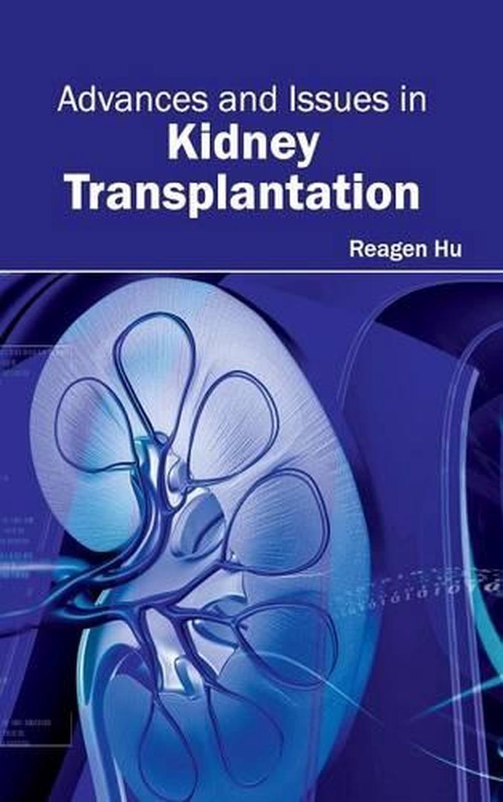 Advances and Issues in Kidney Transplantation (English) Hardcover Book