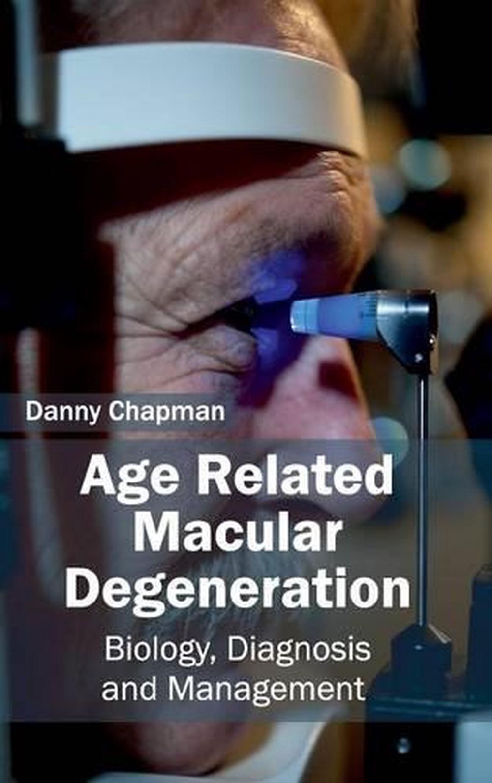 Age Related Macular Degeneration Biology, Diagnosis and Management