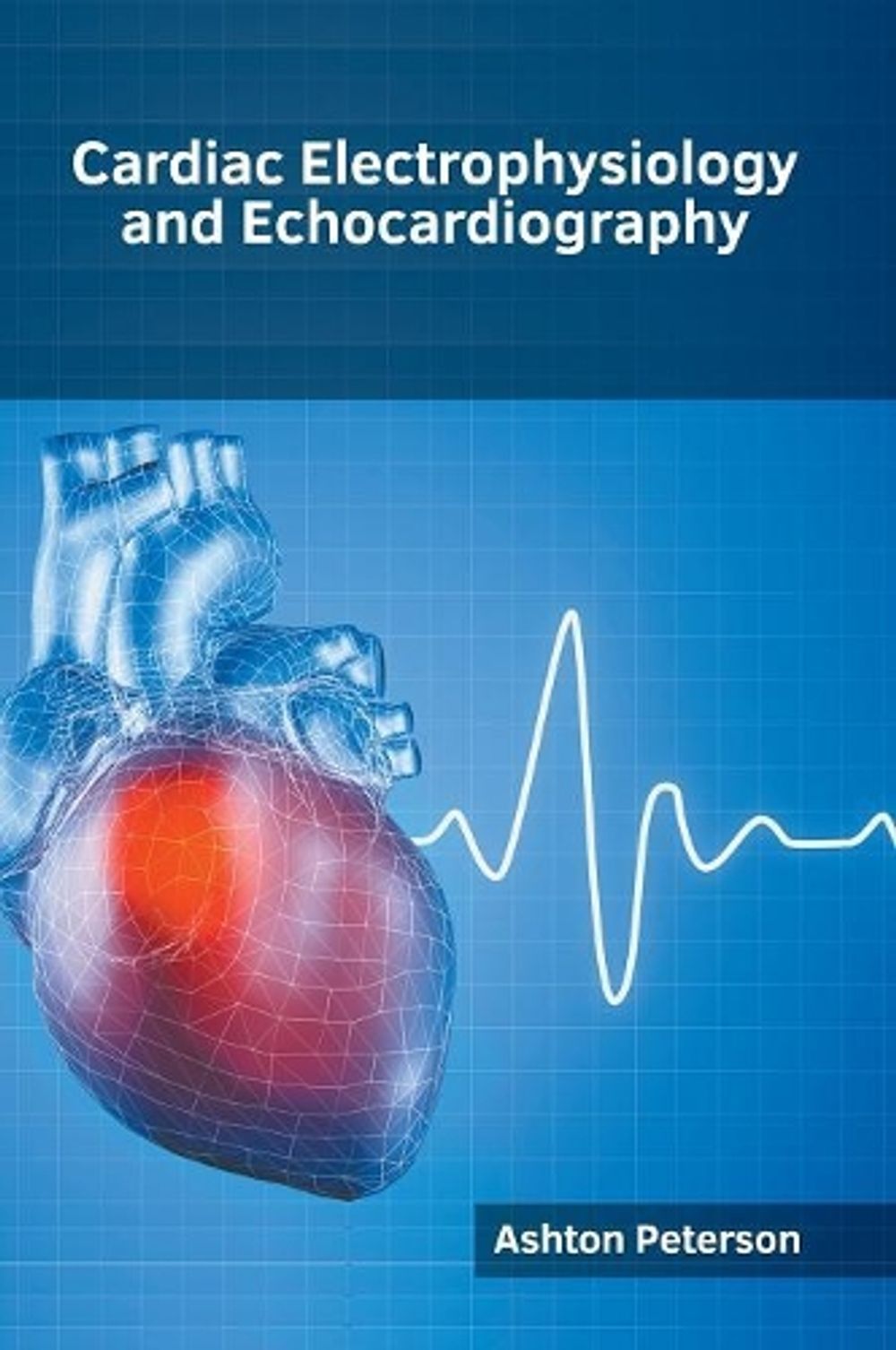Cardiac Electrophysiology and Echocardiography (English) Hardcover Book ...