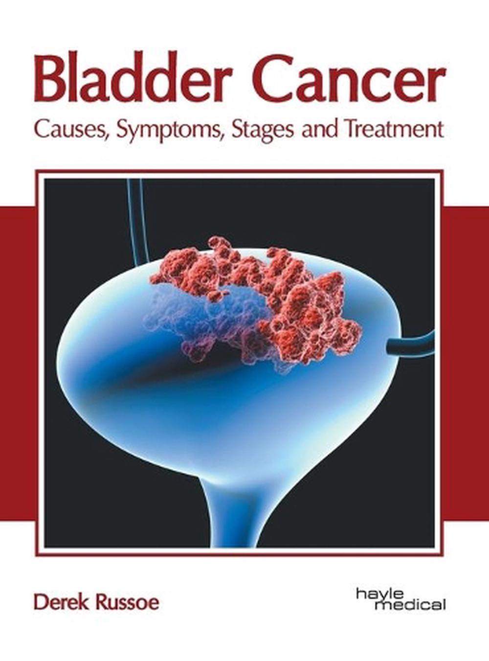 what are the symptoms of stage 2 bladder cancer Updated