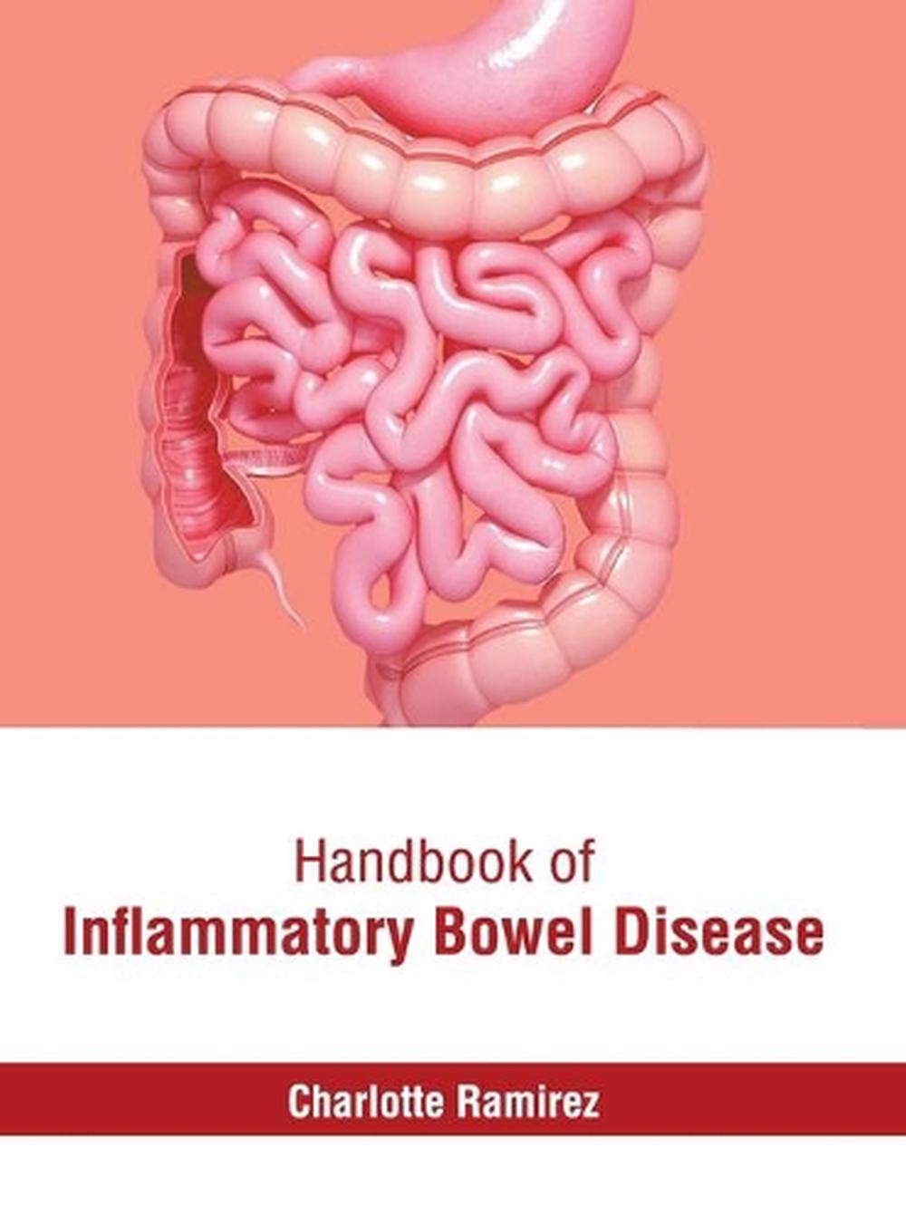 Handbook of Inflammatory Bowel Disease (English) Hardcover