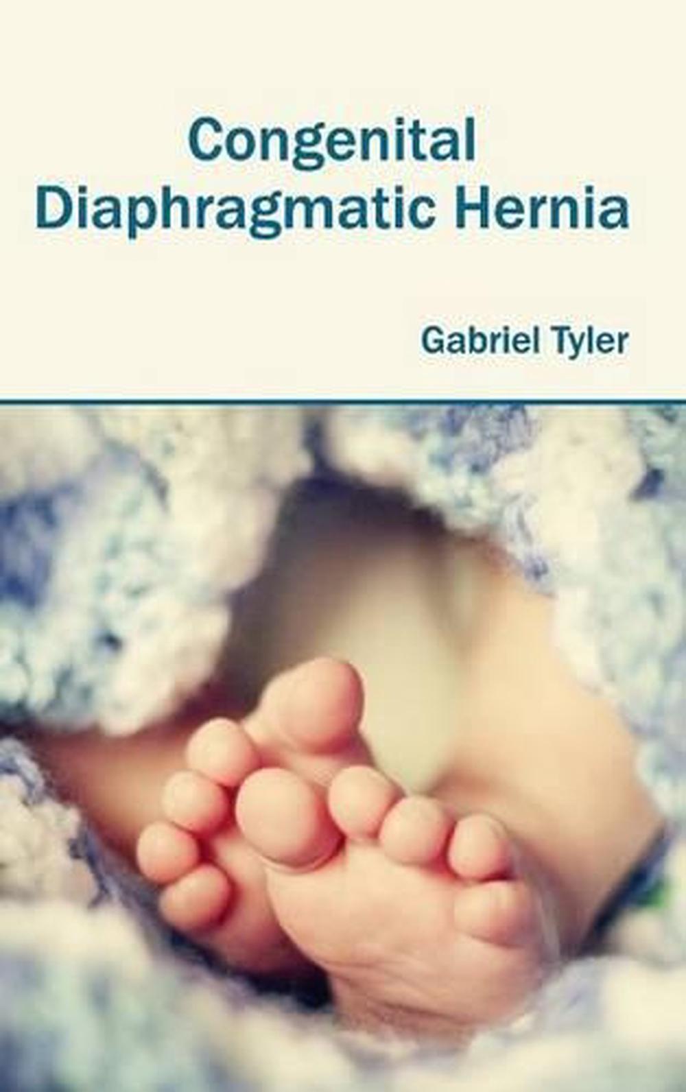 Congenital Diaphragmatic Hernia English Hardcover Book Free Shipping