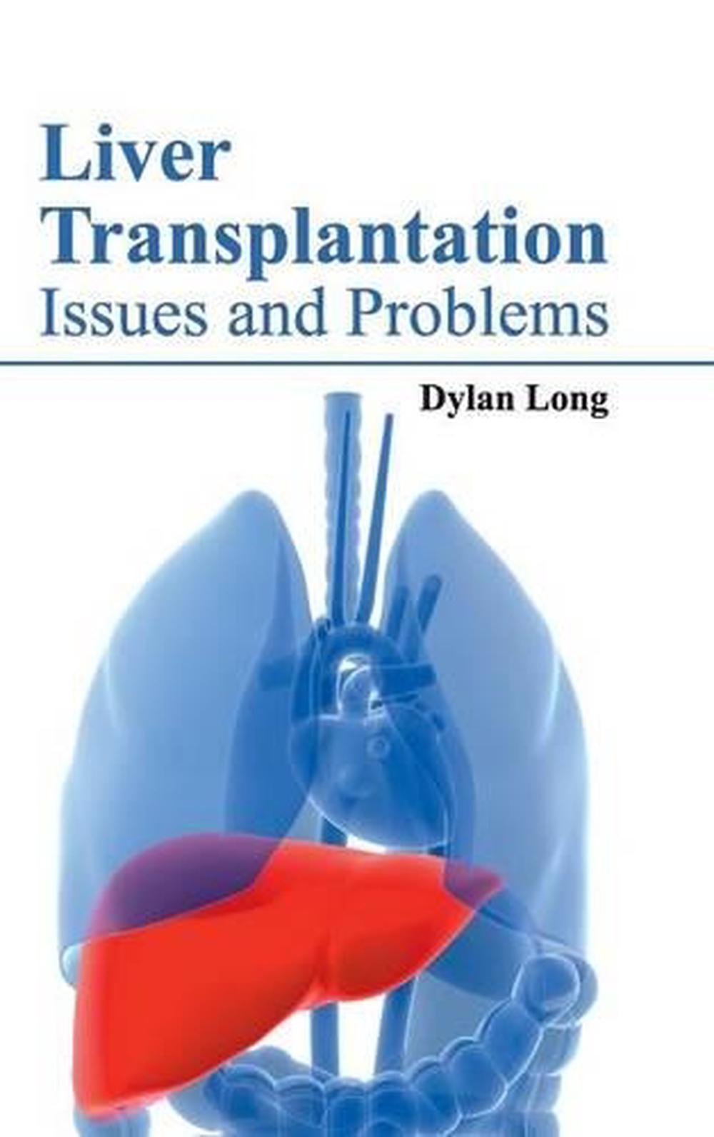 Transplantation immunology essay picture