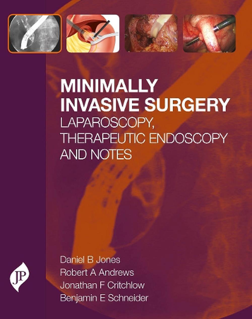 Minimally Invasive Surgery Laparoscopy, Therapeutic Endoscopy and
