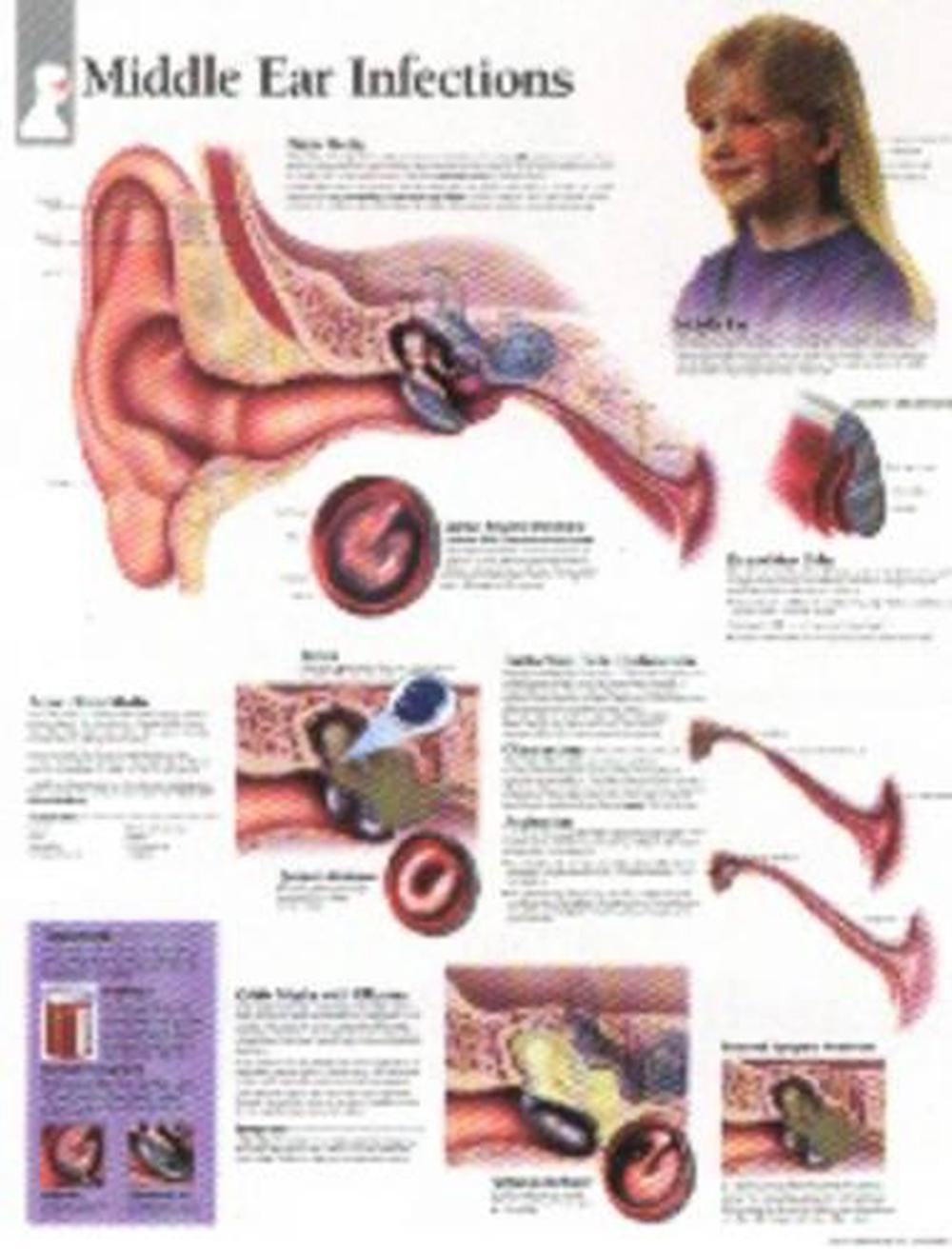 Ear infection treatment for kids picture