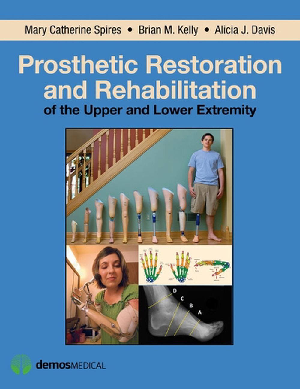 Prosthetic Restoration And Rehabilitation Of The Upper And Lower Extremity By Ma 9781936287666 ...