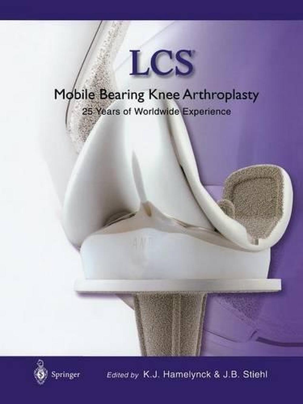 Lcs Mobile Bearing Knee Arthroplasty: A 25 Years Worldwide Review by ...