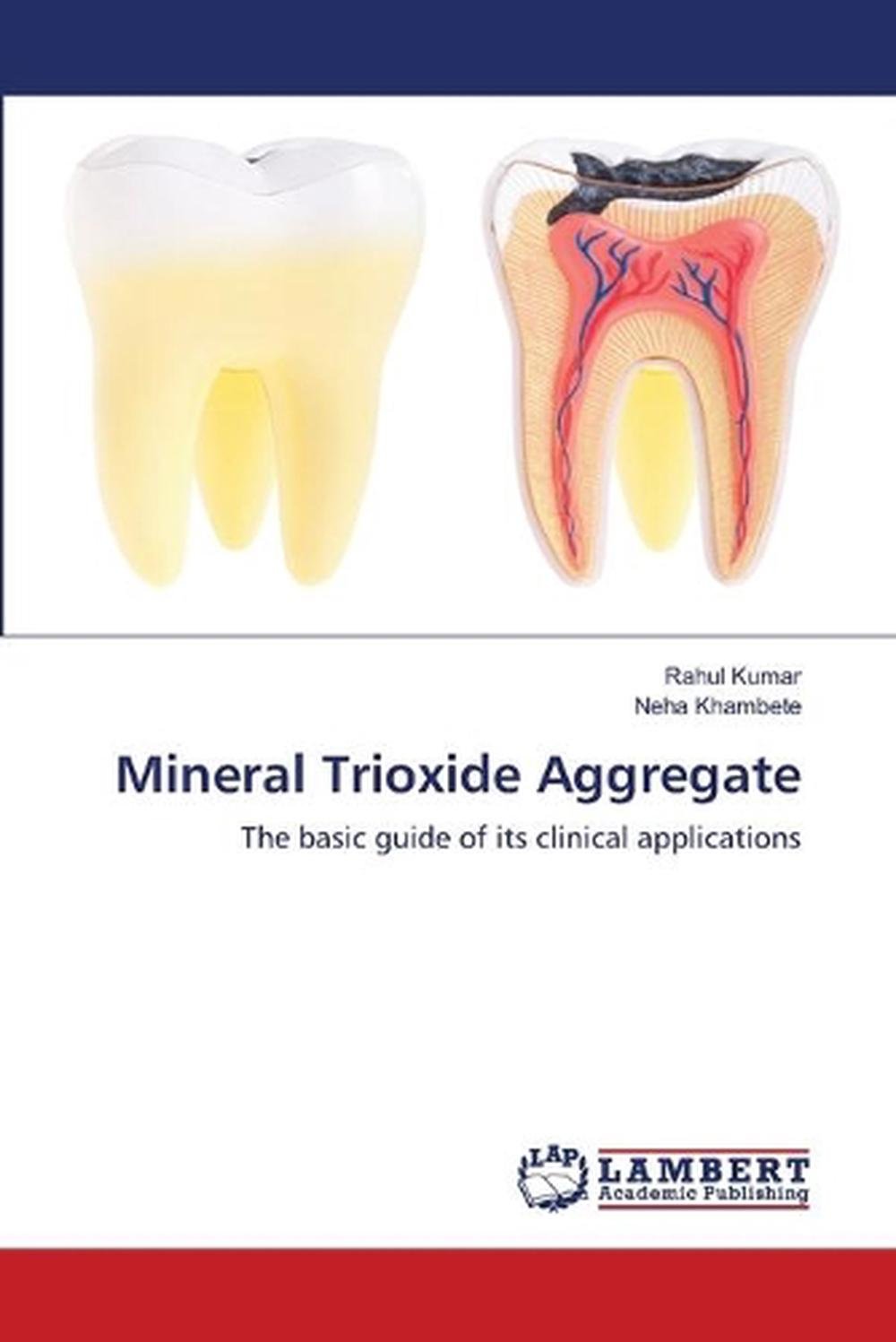 mineral trioxide aggregate a comprehensive literature review