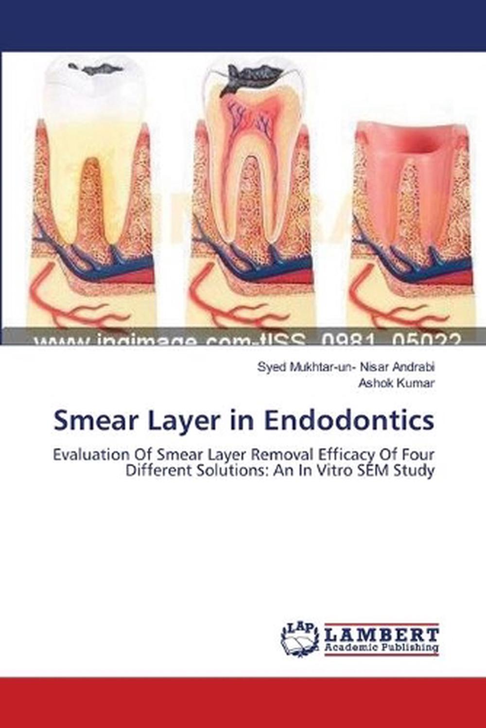 Smear Layer in Endodontics Evaluation Of Smear Layer Removal Efficacy Of Four D 9783659118036