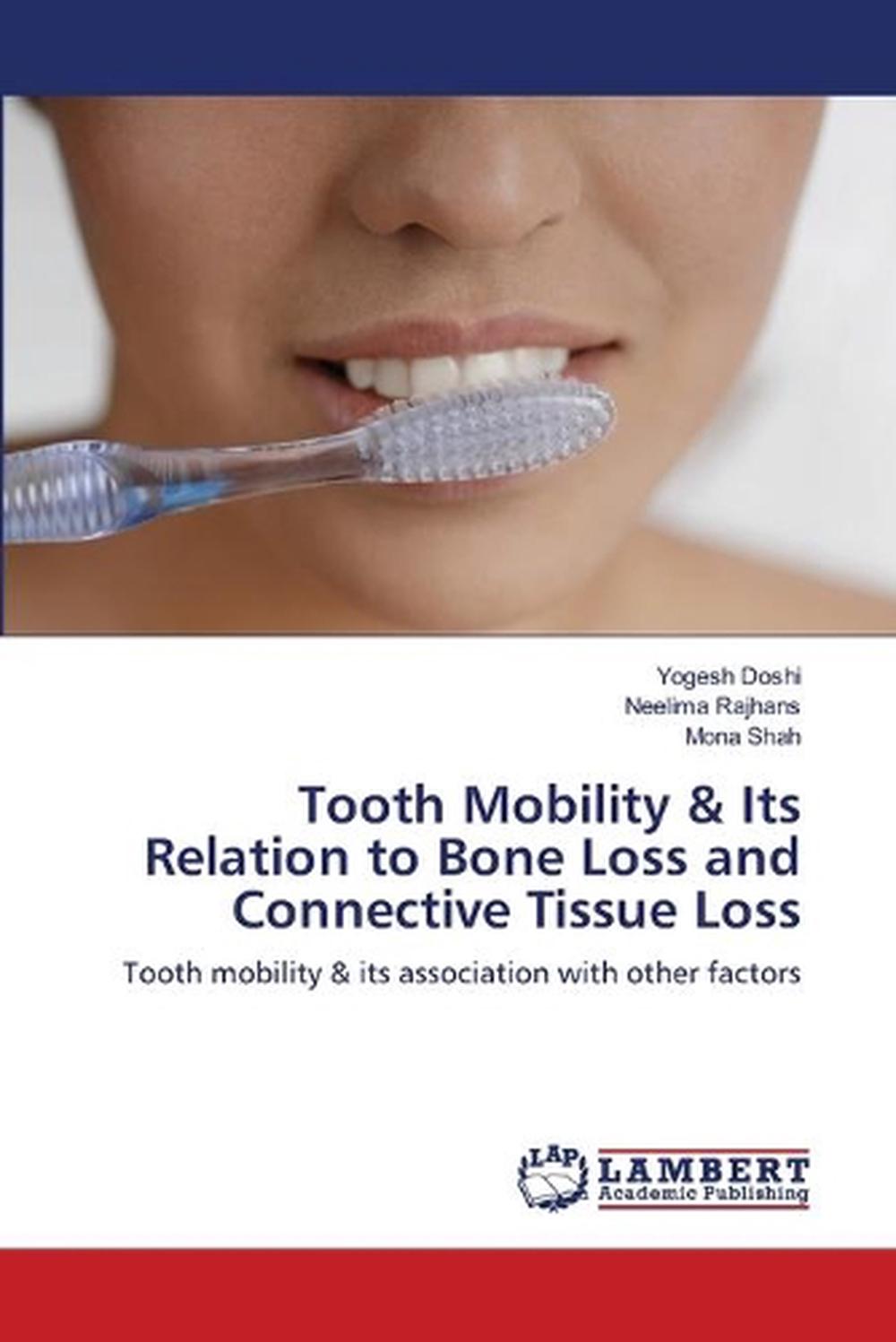Tooth Mobility & Its Relation to Bone Loss and Connective Tissue Loss