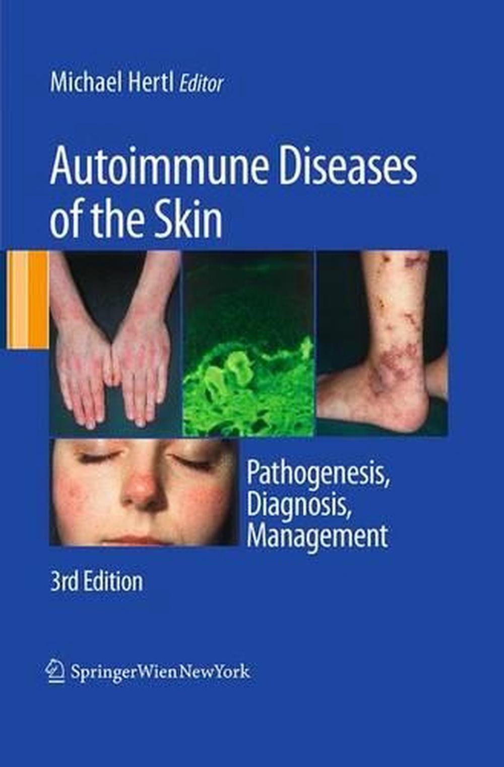 autoimmune disease symptom checklist